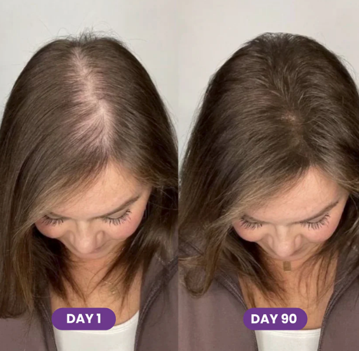 Folli Hair Growth Accelerator Chews