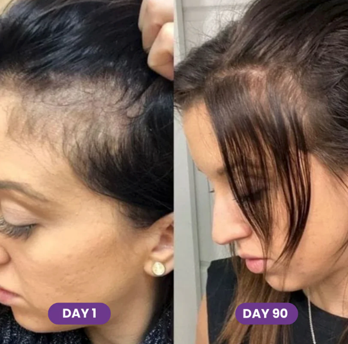 Folli Hair Growth Accelerator Chews